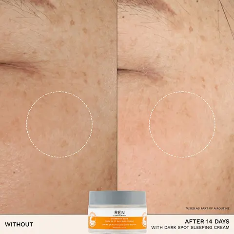 Image 1, WITHOUT *USED AS PART OF A ROUTINE REN AFTER 14 DAYS WITH DARK SPOT SLEEPING CREAM Image 2, 100% SHOWED A REDUCTION IN DARK SPOTS* CLINICAL STUDY AFTER 28 DAYS ON 30 VOLUNTEERS REN CLEAN SKINCARE OVERNIGHT GLO DARK SPOT SLEEPIN DONE DE NUIT ÉCLAT ONCE CO Image 3, BIOACTIVES → ENCAPSULATED ALGAE COMPLEX targets the appearance of dark spots → GLYCOGEN boosts radiance and evens skin tone Image 4, HYDRATES BRIGHTENS PLUMPS EVENS SMOOTHS SUITABLE FOR SENSITIVE SKIN Image 5, RECYCLABLE GLASS JAR 30% PCR PLASTIC LID REN CLEAN SONCARE OVERNIGHT GLOW DARK SPOT SLEEPING CREAM CRÈME DE NUIT ÉCLAT ANTI-TACHES Image 6, STEP 01 CLEANSE STEP 02 EXFOLIATE REN REN STEP 03 TARGET STEP 04 HYDRATE REN REN JELLY OIL CLEANSER READY STEADY GLOW DAILY AHA TONIC BRIGHTENING DARK CIRCLE EYE CREAM DARK SPOT SLEEPING CREAM