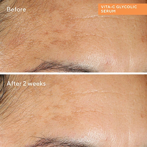 Image 1, before and after 2 weeks. image 2, 91% saw brighter skin, smoother skin with more glow. 94% agreed skin feels softer and more hydrated. proven results reported by trial participants in a 2 week clinical study. image 3, vita-c complex = delivers higher antioxidant defense, is highly bioavailable for increased absorption and ensures the stability and potency of vitamin c to brighten skin. glycolic acid = removes dulling surface cells to enhance vitamin c delivery. phyto-luminescent extract = transforms UV energy into a source of light that illuminates skin. image 4, brighter day and night. effiacious treatments to see fewer dark spots - fast. 1 = vita-c glycolic serum - use in the morning for brightening and antioxidant defense. 2 = rapid dark spot correcting serum - use at night to target dark spots, smooth and boost radiance by morning.