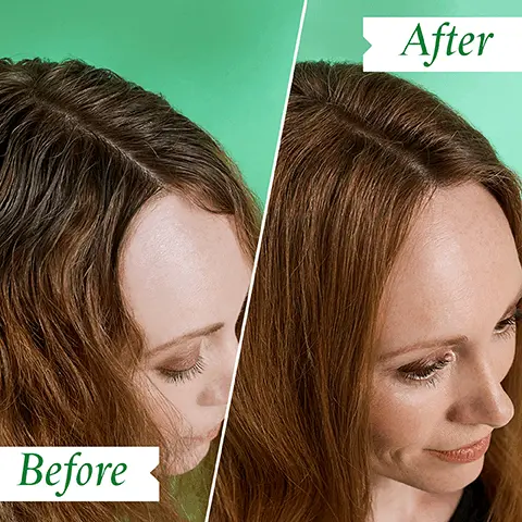 Image 1, Before After Image 2, INVISIBLE on the hair* *INDEPENDENT USER TRIAL KINGSLEY PHILIP FLAKY / ITCHY SCALP Image 3, KEY BENEFITS Targets the root cause of flakes Cools and calms Refreshes the scalp Image 4, KEY INGREDIENTS ALOE VERA Offers mild relief for aggravated scalps ZINC PCA Preserves and protects BISABOLOL A derivative of Chamomile, which calms Image 5, KINGSLEY PHILIP HOW TO USE 1. Shake well before use 2. Keep nozzle 30 cm away from the hair, and spray onto roots 3. Leave for 10 seconds then massage into scalp and hair FLAKY SCALP Image 6, FLAKY/ITCHY SCALP DRY SHAMPOO FLAKY/ITCHY SCALP SHAMPOO KINGSLEY PHILI FLAKY/ITCHY SCALP CALMING SCALP MASK KINGSLEY PHILIP KINGSLEY PHILIP KINGSLEY PHILIP FLAKY/ITCHY SCALP CONDITIONER FLAKY/ITCHY SCALP TONER