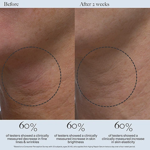 Image 1 - Image shows a side-by-side comparison of skin before and after two weeks of using an anti-aging serum, with circles highlighting the treated areas; visible text reads 60% of testers showed a clinically measured decrease in fine lines & wrinkles, 60% of testers showed a clinically measured increase in skin brightness, and 60% of testers showed a clinically measured increase in skin elasticity.
              Image 2 - A split image showing skin before and after two weeks of using a serum, with the left side displaying uneven skin tone and spots, while the right side shows smoother skin; text reads 100% showed clinically measured improvement in skin texture, 100% showed clinically measured improvement in fine lines & wrinkles, 100% showed clinically measured improvement in skin elasticity.
              Image 3 - An image featuring three transparent blocks labeled with skincare ingredients, including 3% Tetrahexyldecyl Ascorbate, Lilac Stem Cells, and Marine Algae Extracts, accompanied by small purple flowers. Text on the image includes the descriptions of each ingredients benefits.