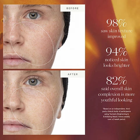 Image 1 - Image shows a side-by-side comparison of a persons face labeled Before at the top and After at the bottom, with statistics about skin improvement; statistics include 98% saw skin texture improved, 94% noticed skin looks brighter, and 82% said overall skin complexion is more youthful looking.
              Image 2 - Image shows three skincare products from KORA Organics: a gold tube labeled Turmeric Brightening & Exfoliating Mask, a new packaging version of the same mask in a gold box, and a white box with an orange image of turmeric powder, all against a light background with the text New Look, Same Formula above.