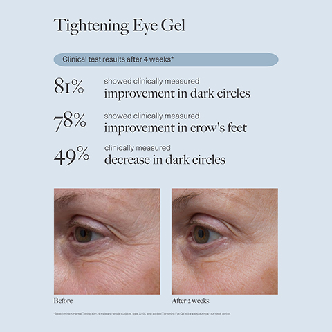 Image 1, tightening eye gel. clinical test results after 4 weeks. 81% showed clinically measure improvement in dark circles. 78% showed clinically measured improvement in crow's feet. 49% clinically measured decrease in dark circles. before and after 2 weeks. based on instrumental testing with 28 male and female subjects, aged 35-55 who applied tightening eye gel twice a day during 4 week period. image 2, tightening eye gel, consumer perception survey results after 4 weeks. 100% agreed product works well under makeup. 95% agreed product feels soothing. 92% agreed the product made them look less tired. before and after 2 weeks. based on consumer reception survey with 37 female subjects aged 35-55 who applied tightening eye gel twice daily during 4 week period. image 3, tightening eye gel before and after 4 weeks. before and after 2 weeks. image 4, intense replenishing serum. consumer perception survey results after 2 weeks. 100% agreed their skin feels more hydrated. 97% agreed their skin feels softer. 97$ agreed the product improved appearance of dull skin. based on a consumer perception study with 37 female subjects aged 35-55 who applied intense replenishing serum twice a day over a 4 week period.