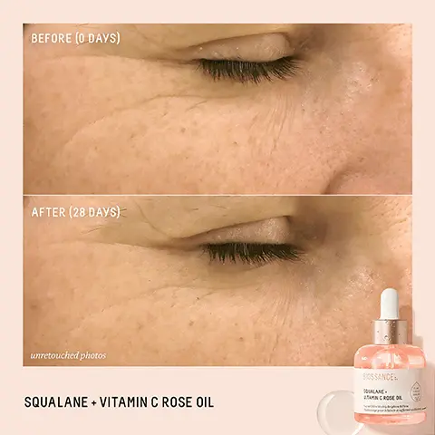 Image 1, BEFORE (0 DAYS) AFTER (28 DAYS) unretouched photos SQUALANE + VITAMIN C ROSE OIL BIOSSANCE ALANE. MOSEL Image 2, BIOSSANCE:. SQUALANE + VITAMIN C ROSE OIL Huile visage pour éclaircir et raffermirisim Facial Oil to Visibly Brighten & Firm AFTER 3 WEEKS 97% agree skin firmness and suppleness is improved1 91% agree skin appears younger looking! 91% agree skin has a healthy radiant glow! Based on a 21-day consumer study of 32 women, ages 18-63. efter 21 days of twice daily use Image 3, MAKEUP MULTITASKER Use as a primer to keep makeup fresh Mix in with liquid foundation for a dewy finish Add a touch to each cheekbone as a highlight BIOSSANCE: SQUALANE + VITAMIN C ROSE OIL Facial Oil to Visibly Brighten Firm age pour eclaireret afermavim Image 4, → CHIOS CRYSTAL OIL Helps revitalize the skin while visibly improving firmness SUGARCANE-DERIVED SQUALANE Weightlessly locks in essential moisture BIOSSANCE:. SQUALANE. WITAMIN C ROSE OIL Visibly Brigters Firm Hi pour éclair et raffermir galimot ◆ ADVANCED VITAMIN C (THD ASCORBATE) An oil-soluble, stable form of vitamin C that visibly brightens the skin