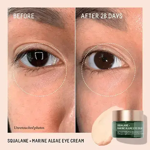 Image 1, BEFORE AFTER 28 DAYS Unretouched photos SQUALANE + MARINE ALGAE EYE CREAM SQUALANE. MARINE ALGAE EYE CREA Image 2, SQUALANE MARINE ALGAE EYE CREAM Visibly Firms Instantly Smocks Elle raffermit & lise visiblement zoned AFTER 1 USE 97% showed improvement in the appearance of fine lines and wrinkles1 97% agree the skin around their eye area appears firmer2 AFTER 1 WEEK 94% agree the look of their dark circles is improved? Based on a 28 day clinical study of 33 female subjects. oges 35-60, after twice daily use *Based on a 28 day consumer study of 33 female subjects. oges 35-60, after twice daily uset Image 3, POWERFUL FORMULAS, EYE-CONIC RESULTS BIOSSANCE:. SQUALANE. PEPTIDE EYE GEL SQUALANE-MARINE ALGAE EYE CREAM SQUALANE + PEPTIDE EYE GEL Lightweight gel Visibly reduces dark circles Reduces the look of puffiness HOW TO USE Apply to the eye area after cleansing. Layer gel before cream for maximum benefits. SQUALANE + MARINE ALGAE EYE CREAM Soft cream Lifts, firms, and smooths Minimizes the appearance of fine lines Image 4, MARINE ALGAE COMPLEX Visibly reduces fine lines and wrinkles SQUALANE + MARINE ALGAE EYE CREAM Eye Cream Visibly Firms Instantly Crème yeux raffermit visiblement et le int SUGARCANE-DERIVED SQUALANE Weightlessly locks in essential moisture PARACRESS EXTRACT Quickly smooths and firms the look of skin Image 5, LANCE: SQUALANE + MARINE ALGAE EYE CREAM Eye Cream Visibly Firstly Crème yeux raffermit visiblement AFTER 1 USE 97% showed improvement in the appearance of fine lines and wrinkles1 97% agree the skin around their eye area appears firmer2 AFTER 1 WEEK 94% agree the look of their dark circles is improved2 Based on a 28 day clinical study of 33 female subjects. oges 35-60, after twice daily use *Based on a 28 day consumer study of 33 female subjects. oges 35-60, after twice daily uset Image 6, PARACRESS EXTRACT Quickly smooths and firms skin MARINE ALGAE COMPLEX Visibly reduces fine lines and wrinkles SQUALANE MARINE ALGAE EYE CREAM Instantly Only Crone you caffermit visiblemet e lir SUGARCANE-DERIVED SQUALANE Weightlessly locks in moisture Image 7, AMAZING! INSTANT DARK CIRCLE REMOVER, FINE LINES DISAPPEARED, AND MY EYES LOOK FIRMER AND LIFTED! Image 8, best of beauty Allure the beauty expert 2020 award winner