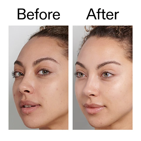 Image 1 - A split image shows a womans face before and after a treatment, with the left side displaying visible skin texture and the right side showing smoother, more radiant skin. The visible text reads Before After. Image 2 - A close-up shows a persons eye and cheek with a finger gently touching the skin, next to visible text that reads: 90% said their skin was noticeably brighter after 7 days* 92% agreed this product was gentle on skin and didnt cause irritation* *Tested on 51 people, with at least 1 weeks usage. Image 3 - Close-up of a smiling persons face with dewy-looking skin showing their eyes, nose, and mouth, with text that reads Why we love it Luxurious gel texture Improves appearance of uneven skin tone Gentle enough for daily use, even on sensitive skin. Image 4 - A close-up of a golden-brown liquid with particles on the right side of a white background, next to text on the left listing product benefits: Why it works 0.5% Nordic Beauty Peat GENTLY EXFOLIATES FOR BRIGHTER AND SMOOTHER SKIN. 1.5% Kakadu Plum Complex INSTANTLY BOOSTS SKINS RADIANCE AND LUMINOSITY. 1% Liquorice Root Extract REDUCES HYPERPIGMENTATION AND BRIGHTENS OVERALL SKIN TONE. 0.5% Aloe Vera SOOTHES AND CALMS THE SKIN. Image 5 - A hand holds a white squeeze tube labeled FULVIC ACID, 5.0 US fl.oz / 150ml e, Helps brighten skin and gently remove, Aide à illuminer la peau et éliminer en, with additional text on the left describing How to use, USE AM + PM., RASPBERRY SIZE AMOUNT., MASSAGE INTO DAMP SKIN, THEN RINSE WELL WITH WARM WATER., USE ALONE, OR THE SECOND STEP IN A DOUBLE-CLEANSE ROUTINE. Image 6 - A golden-yellow bubbly liquid sits at the bottom of a white background with text that reads How to layer your routine, followed by a numbered list 1 CLEANSE, 2 HYDRATE, 3 TREAT, 4 MOISTURISE, 5 SPF.