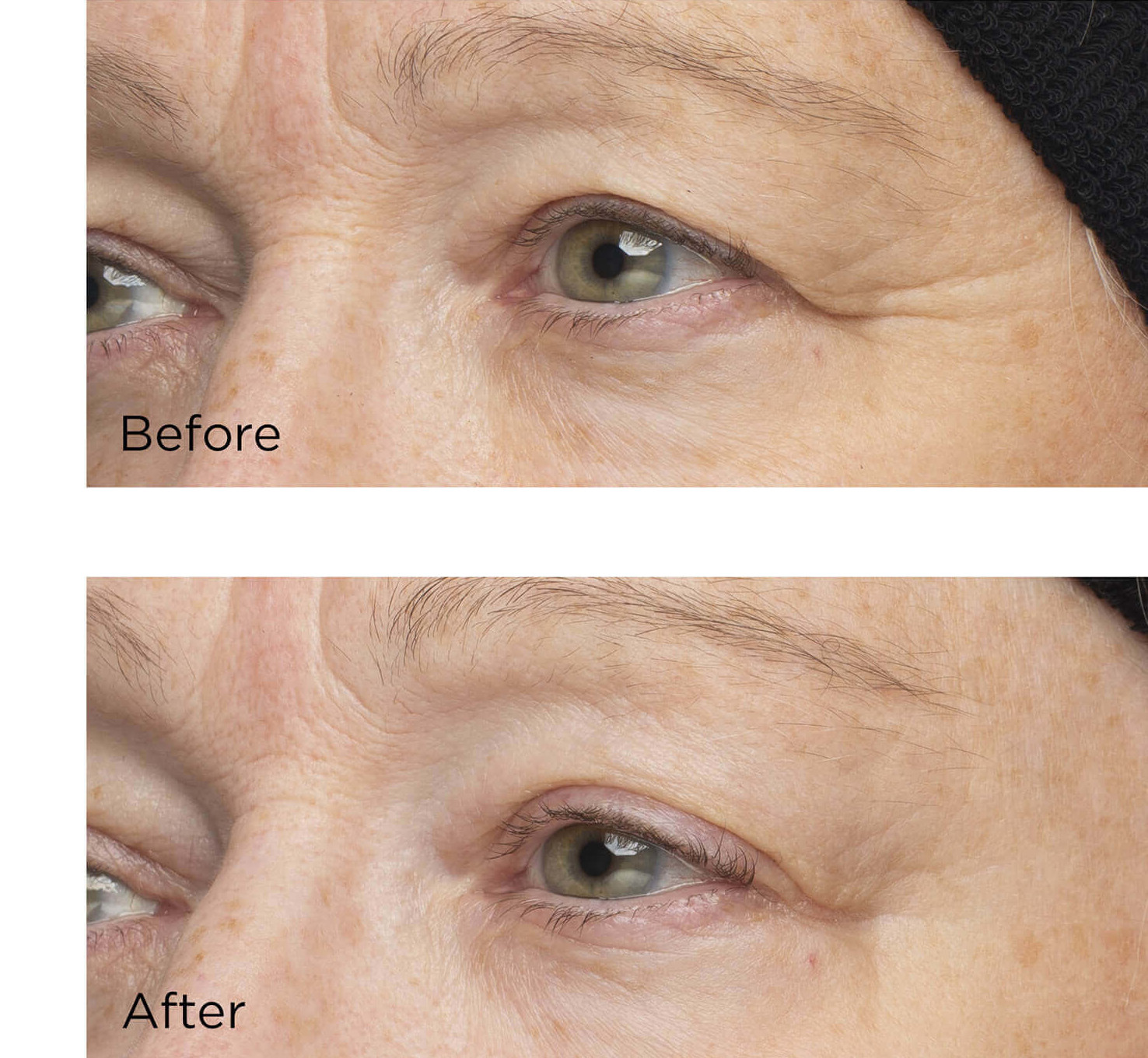 Before and After model shot