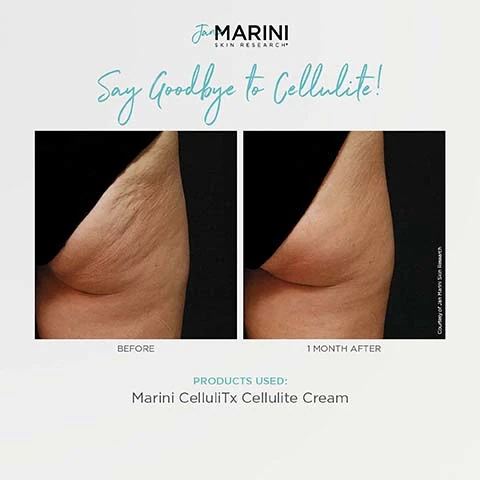 say goodbye to cellulite before and 1 month after, marini celluliTx cellulite cream.