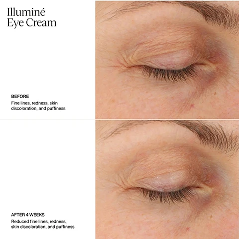 image 1, illumine eye cream. before - fine lines, redness, skin discoloration and puffiness. after 4 weeks - reduced fine lines, redness, skin discoloration and puffiness. Image 2, illumine eye cream. before - under eye skin discoloration. after 8 weeks - reduced discoloration. after 12 weeks - significantly reduced discoloration.