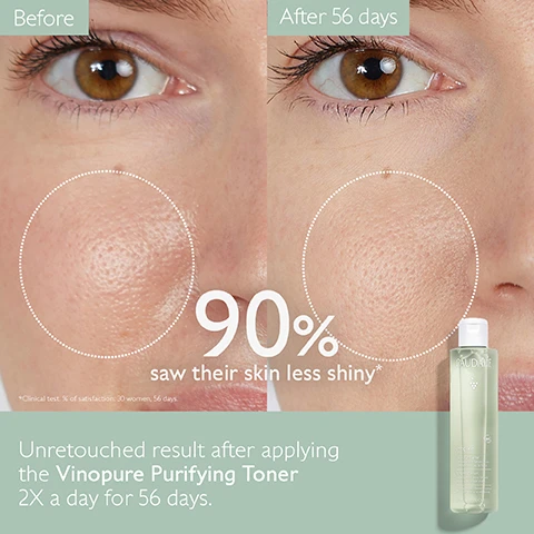 Image 1, before and after 56 days. 90% saw their skin less shiny. unretouched result after applying the vinopure purifying toner, 2 times a day for 56 days. image 2, clear, shine free skin. 90% saw their skin less shiny. image 3, natural salycilic acid = visibly unclogs pores and refines skin texture. organic grape water = moisturising, soothing, anti-oxidant prebiotic. organic rose water = reduces shine, limits sebum. image 4, 1 = cleanse with purifying gel cleanser. 2 = purify with purifying toner. 3 = correct with blemish control salicylic serum. 4 = mattify with moisturising mattifying fluid. 5 = target with salicylic spot solution.