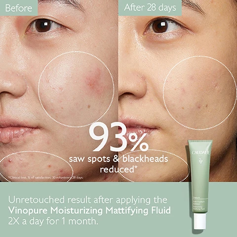 Image 1, before and after 28 days. 93% saw spots and blackheads reduced. unretouched result after applying the vinopure moisturising mattifying fluid 2 times a day for 1 month. image 2, skin texture refined. 93% saw spots and blackheads reduced. image 3, polyphenls = antioxidant. plant squalane = hydrates and soothes. silica powder = mattifies. image 4, 1 = cleanse with purifying gel cleanser. 2 = purify with purifying toner. 3 = correct with blemish control salicylic serum. 4 = mattify with moisturising mattifying fluid. 5 = target with salicylic spot solution.