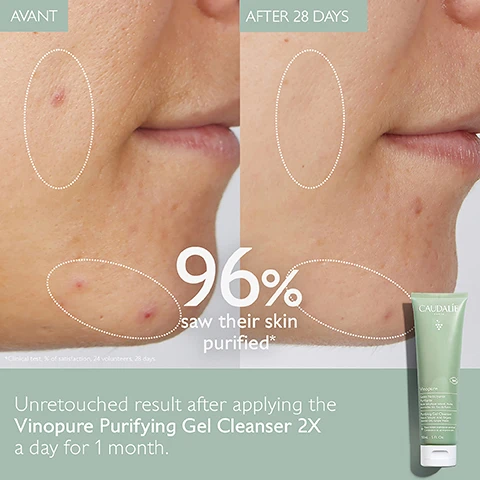 Image 1, before and after 28 days. 96% saw their skin purified. unretouched results after applying the vinopure purifying gel cleanser 2 times a day for 1 month. image 2, clear, fresh and glowing skin. 96% saw their skin purified. image 3, natural salicylic acid = visibly unclogs pores and refines skin texture. polyphenols = antioxidant. image 4, 1 = cleanse with purifying gel cleanser. 2 = purify with purifying toner. 3 = correct with blemish control salicylic serum. 4 = mattify with moisturising mattifying fluid. 5 = target with salicylic spot solution.