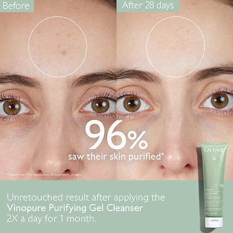 Image 1 - Side-by-side comparison of a persons face showing the skin before and after 28 days of using a skincare product, with visible text stating 96% saw their skin purified and the product name, Vinopure Purifying Gel Cleanser, along with usage instructions.
              Image 2 - Image showing a side-by-side comparison of a persons cheek before and after using Vinopure Purifying Gel Cleanser for 28 days, with highlighted areas showing improvement in skin appearance, and text stating 96% saw their skin purified and the products name at the bottom left.
              Image 3 - A person with wet skin and a smile is applying a facial cleanser with one hand, and text on the image states Clear, fresh and glowing skin 96% saw their skin purified*.
              Image 4 - Image of a green tube of Caudalie Vinopure purifying gel cleanser surrounded by natural elements like flower petals, lavender, and leaves, with visible text stating Natural salicylic acid, Visibly unclogs pores & refines skin texture, Polyphenols, Antioxidant.
              Image 5 - Image shows a side-by-side comparison of two facial cleansers: on the left, a bottle of Vinoclean Foaming Cleanser with descriptions indicating it has a foam texture, gently cleanses and purifies, suitable for all skin types; on the right, a tube of Vinopure Gel Cleanser with descriptions indicating it has a gel texture, cleanses and reduces blemishes, suitable for acne-prone skin.
              Image 6 - Image shows a hand holding a tube of Caudalie Purifying Gel Cleanser with bubbles, accompanied by recycling instructions: 1 Dispose of tube in recycling bin* 2 Recycle cap with TerraCycle.
              Image 7 - Image shows a collection of skincare products arranged aesthetically, labeled with steps 1 to 5: 1. CLEANSE - Purifying Gel Cleanser, 2. PURIFY - Purifying Toner, 3. CORRECT - Blemish Control Salicylic Serum, 4. MATTIFY - Moisturizing Mattifying Fluid, and 5. TARGET - Salicylic Spot Solution.