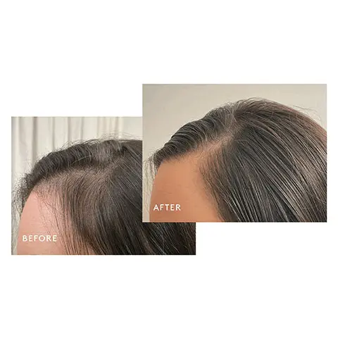 Image 1, Before and after 6 months of Nightly Hair Rejuvenation Treatment use. Image 2, three swatches show the texture and consistency of their product. Swatch 1. Shampoo for thinning hair 2. Conditioner for thinning hair 3. Density Booster