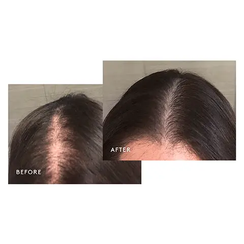 Image 1, Before and after 4 months of Nightly Hair Growth Treatment use. Image 2, Three swatches to show the texture and consistency of their product. Swatch 1, Shampoo for thinning hair 2. Conditioner for thinning hair 3. Minoxidil