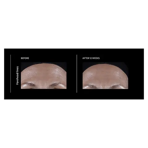 Image 1 to 3, Before and after model shot. Image 4, Peptide pro complex, proprietary technology that contains proven efficacious levels of neuropeptides, proteins, amino acids and marine extracts. Helps visibly improve the appearance of expression lines, skin roughness and laxity. Powerful blend of ingredients work, synergistically.