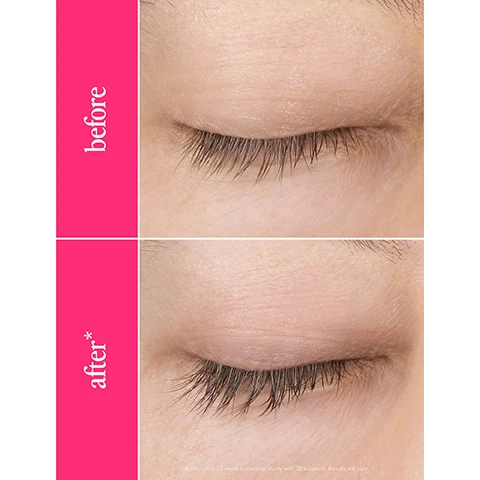 Image 1 - An image showing two close-up photos of an eye, with the top labeled before and the bottom labeled after, highlighting the improvement in eyelash length and thickness.
              Image 2 - A side-by-side comparison showing a close-up of a persons closed eyes with visible eyelashes; the top image labeled before shows shorter eyelashes, while the bottom image labeled after shows longer, fuller eyelashes, with a note that results may vary.
              Image 3 - A woman with long, wavy hair is holding a lash serum in one hand and looking at the camera; the background is pink with text that reads 2 weeks healthier, stronger looking lashes* and 4-6 weeks longer, thicker looking lashes*.
              Image 4 - A hand holding a gold eyelash serum tube is shown against a bright pink background, accompanied by text from Allure and NewBeauty highlighting positive reviews: If youve tried everything but a lash serum to get longer-looking eyelashes, its time you invest in this top pick. and The results look and feel natural - like your lashes, but better. with icons indicating awards and reviews.
              Image 5 - Image of an award-winning lash enhancing serum with a black and gold tube positioned upright beside its applicator brush, with pink text that reads promotes longer & thicker looking lashes in as little as 4-6 weeks compatible with lash extensions, lash-lifts, falsies, & contacts easy to use apply 1x daily 11 safety studies & ophthalmologist tested.
              Image 6 - An image featuring a tube of lash serum surrounded by honeycomb, aloe vera, and radishes, with text that reads PACKED WITH CREDIBLE, SCIENCE BACKED, Lash Loving Ingredients and lists ingredients including Hyaluronic Acid and Honey & Aloe Vera.
              Image 7 - A close-up of a persons eye being treated with a brush, with text instructions that read apply 1x daily for 3 months for full results, apply single stroke to upper lash line, and let dry for 2-3 minutes before applying other products or laying down.
              Image 8 - Image shows a guide for lash serum sizes with three product options labeled as Travel Size (6 Week Supply), Full Size (3 Month Supply), and Jumbo Size (6 Month Supply), each with text indicating results at different stages: Week 6 - Perfect to try Im starting to see initial results, Week 12 - Full Results My lashes look UNREAL, and 6 Months - Maintain Results I cant live without it.