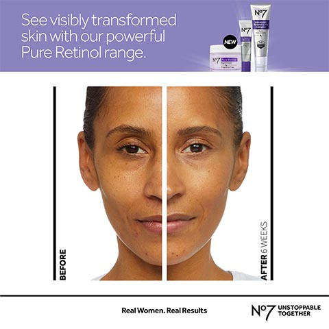 See visibly transformed skin with our powerful Pure Retinol range. Before, After 6 weeks. Real women. Real results. No7 unstoppable together.