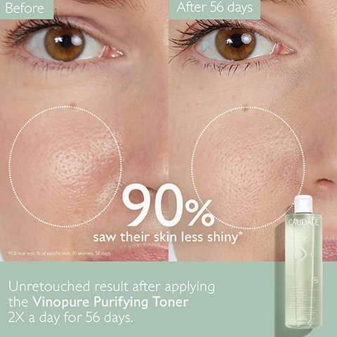 Image 1 - Image shows a side-by-side comparison of two close-up photos of a womans face, labeled Before on the left and After 56 days on the right, with an indication that 90% saw their skin less shiny, along with an image of a bottle of Vinopure Purifying Toner, and text stating Unretouched result after applying the Vinopure Purifying Toner 2X a day for 56 days.
              Image 2 - A man is gently applying a cotton pad to his face with a focused expression, accompanied by text stating Clear, shine-free skin and 90% saw their skin less shiny*.
              Image 3 - A bottle of Caudalie Vinopure Purifying Toner is shown, surrounded by lavender, rose petals, and greenery, with the text highlighting key ingredients: Natural salicylic acid, organic grape water, and organic rose water, along with benefits like visibly unclogs pores and reduces shine.
              Image 4 - Image shows two toner products side by side with their names: Vinoclean Toner on the left with a transparent bottle and Vinopure Toner on the right in a green bottle, with text highlighting their features, including Removes the last traces of make-up, hydrates and tones for Vinoclean and Anti-blemish and Acne-prone skin for Vinopure.
              Image 5 - Image of five skincare products arranged on a light green background, labeled with steps for use: 1. Cleanse - Purifying Gel Cleanser, 2. Purify - Purifying Toner, 3. Correct - Blemish Control Salicylic Serum, 4. Mattify - Moisturizing Mattifying Fluid, 5. Target - Salicylic Spot Solution.