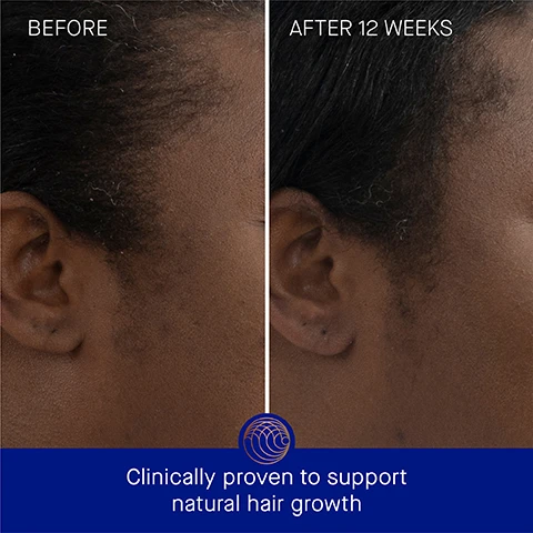 Image 3 - Side-by-side comparison of a persons hairline before and after 12 weeks of treatment, with visible text stating BEFORE on the left and AFTER 12 WEEKS on the right, along with the text Clinically proven to support natural hair growth at the bottom.
              Image 4 - An image showing two comparisons of the same persons hair: the left side labeled Before shows sparse hair, while the right side labeled After 12 Weeks displays fuller, healthier hair with text at the bottom stating Clinically proven to support natural growth and boost shine.
              Image 5 - A metallic orange bottle of Augustinus Bader scalp treatment is positioned on a textured surface with droplets of water surrounding it, featuring text that reads Clinically Proven Results, Hair hydration is increased by 74%, Hair strength is increased by over 2x, and Hair count is increased by 22%, along with a note about a clinical trial.
              Image 6 - An image showing a brown bottle of hair treatment with a dropper, alongside text indicating user proven results: 95% agree scalp dryness feels reduced, 94% agree natural hair growth is visibly improved, 94% agree hair appears thicker, with a footnote about a consumer perception study.
              Image 7 - An orange cylindrical bottle labeled Augustinus Bader sits against a blue background, with text highlighting various ingredients and benefits: TFC8, Hazel Leaf Extract, Multi-Mineral Active Complex (Magnesium, Zinc + Copper), and L-Arginine, along with their respective descriptions.
              Image 8 - An image depicting a hair care routine with five steps, each featuring a product; the steps are labeled 1. Cleanse: The Rich Shampoo, 2. Condition: The Rich Conditioner, 3. Renew: The Scalp Treatment, 4. Revitalize: The Leave In-Hair Treatment, and 5. Nourish: The Hair Oil.