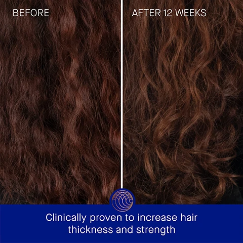 Image 3 - A comparison image showing hair before treatment on the left with a darker color and after 12 weeks on the right with a lighter and healthier appearance, with the text clinically proven to increase hair thickness and strength at the bottom.
              Image 4 - Image shows a side-by-side comparison of hair before and after 12 weeks of treatment, with the left side displaying frizzy, loose curls labeled BEFORE and the right side showing smoother, healthier curls labeled AFTER 12 WEEKS, with the text Clinically proven to increase volume and strength at the bottom.
              Image 5 - A blue shampoo bottle with a copper cap, surrounded by water droplets, displays text that states Clinically Proven Results, Hair strength is increased by 2.9x, Hair strand thickness is increased by 2.9x, and Hair count is increased by 16%.
              Image 6 - A person holding a blue shampoo bottle with a copper cap, textured background, and text highlighting user proven results: 88% agree natural hair growth is visibly improved, 92% agree hair appears more full, 91% agree hair feels thicker, and a note about a 12-week consumer perception study.
              Image 7 - A blue bottle of shampoo labeled Augustinus Bader is set against a gradient background with descriptions around it, highlighting TFC8 technology, neem extract, watercress and Indian cress extracts, and maca root extract along with their benefits for hair.
              Image 8 - Image shows a comparison of two shampoo products from Augustinus Bader: The Shampoo, which is a weightless gel cleanser ideal for finer hair types, and The Rich Shampoo, which is a rich cream cleanser suitable for thicker hair types; both images have text highlighting their textures, key benefits, key concerns, and ideal hair types.