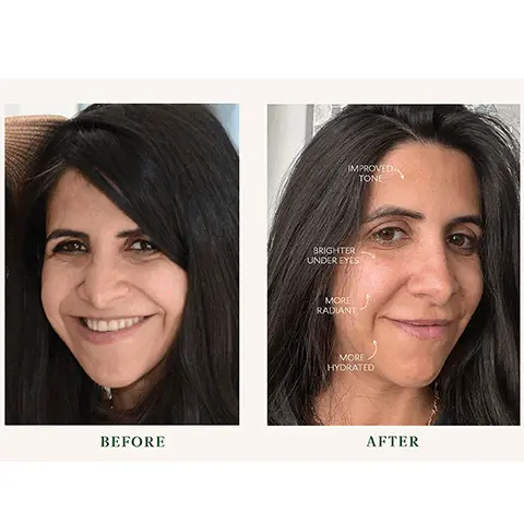 Image 1 and 2, before and after, more radiant, less redness, smoother skin.