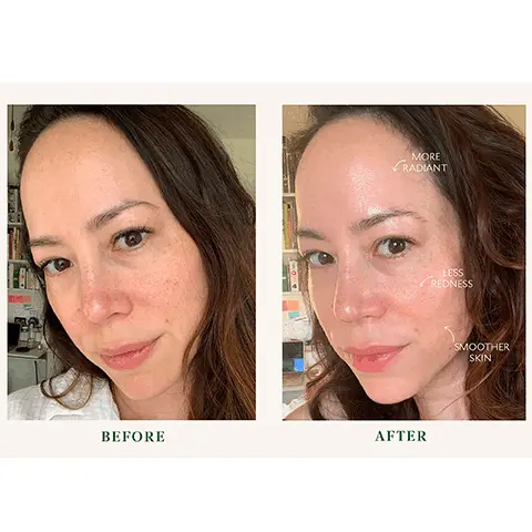 Image 1 and 2, before and after, more radiant, less redness, smoother skin.