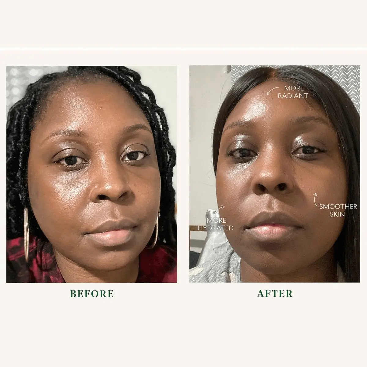 Image 1, before and after, more radiant, more hydrated and smoother skin. Image 2, before and after, improved tone, brighter under eyes, more radiant, more hydrated. Image 3, more radiant, less redness, smoother skin