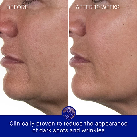 Image 3 - Side-by-side images showing a persons profile, with the left labeled Before showing noticeable wrinkles and skin texture, and the right labeled After 12 Weeks displaying smoother skin; below the images is text stating Clinically proven to reduce the appearance of dark spots and wrinkles.
              Image 4 - A blue skincare bottle with a bronze pump cap is displayed on a light background, accompanied by text that states skin hydration improved by 2.4x, skin firmness and elasticity improved by 36%, and the appearance of forehead wrinkles visibly reduced by 37%.
              Image 5 - An image of a blue skincare bottle with a gold cap on a light marble background, accompanied by text that states: User Proven Results, 100% agree skin feels instantly hydrated and nourished, 100% agree complexion looks plump and replenished, 95% agree the appearance of fine lines/wrinkles is dramatically improved, and a note about a consumer perception study.
              Image 6 - An image of a blue bottle of The Rich Cream by Augustinus Bader, displaying text describing its benefits, including TFC8® supporting skin cellular renewal, Evening Primrose Oil improving skin elasticity, Argan Oil rebuilding moisture barriers, and Hyaluronic Acid providing hydration.
              Image 7 - Image of two skincare products side by side, one titled The Cream with a description of a lightweight daily moisturizer and key benefits including hydrating and revitalizing, and the other titled The Rich Cream with a description of a luxuriously rich daily moisturizer and key benefits of nourishing and renewing.
              Image 8 - Image shows a skincare routine layout with four steps and corresponding product images, including a cleansing gel, a serum, creams, and an eye cream, along with visible text outlining each step and product. The visible text reads: The Routine 1. Cleanse THE CREAM CLEANSING GEL 2. Correct & Hydrate THE SERUM 3. Nourish & Renew THE CREAM, THE RICH CREAM OR THE ULTIMATE SOOTHING CREAM 4. Perfect & Revitalize THE EYE CREAM.
              Image 9 - Four skincare bottles from Augustinus Bader are displayed: a tall bottle labeled The Rich Cream with TCFB in blue with golden accents (100 ml), followed by a medium bottle (50 ml), a smaller bottle (30 ml), and a mini bottle (15 ml), all featuring similar design elements and product labeling.