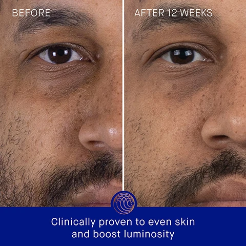 Image 3 - Image showing a side-by-side comparison of a mans face, with the left side labeled Before showing uneven skin tone, and the right side labeled After 12 Weeks displaying significant improvement in skin tone, along with visible text at the bottom stating Clinically proven to even skin and boost luminosity.
              Image 4 - Side-by-side comparison of a mans face showing the left side labeled BEFORE with visible blemishes and wrinkles, and the right side labeled AFTER 12 WEEKS with clearer skin; text below states Clinically proven to reduce the appearance of blemishes.
              Image 5 - A serum bottle is displayed on a gradient background with text stating Clinically Proven Results, the appearance of even skin tone is improved by over 3.6x, the appearance of wrinkles is reduced by 85%, and skin hydration is improved by over 3.9x.
              Image 6 - A metallic gold skincare bottle is positioned on a textured beige surface with text stating user proven results including percentages indicating agreement on skin luminosity, softness, elasticity, and reduced fine lines and wrinkles.
              Image 7 - A blue cosmetic bottle with a gold top, labeled Augustinus Bader, surrounded by text explaining ingredients: TFC8® - A proprietary technology that creates the optimal environment for skin cellular renewal, Pomegranate Seed Concentrate - Soothes and balances stressed skin, Edelweiss Extract - Known to help lift, smooth and tighten sagging skin and wrinkles, Vitamin C - Helps support the natural production of collagen for firmer, more resilient skin.
              Image 8 - Image shows three steps for a skincare application process with orange packaging products in the first image, a person applying product on their neck in the second, and another person smoothing product onto their face in the third, with text that reads Step 1: Dispense 2 pumps into hands, Step 2: In upward sweeping motions, smooth over the face, neck and decollete until fully absorbed, Step 3: Follow by applying your Augustinus Bader moisturizer and eye cream.
              Image 9 - Image shows two skincare serums side by side: on the left, an orange bottle labeled The Serum with details about its lightweight gel-serum texture, benefits of correcting and illuminating, concerns of fine lines, dark spots, and ideal for normal to very dry skin; on the right, a blue bottle labeled The Retinol Serum with a lightweight cream-serum texture, benefits of smoothing and refining, concerns of deep lines, blemishes, and ideal for oily to very dry skin.
              Image 10 - An image showing a skincare routine layout with product images and text: the first step is 1. Cleanse with THE CREAM CLEANSING GEL, followed by 2. Correct & Hydrate with THE SERUM, 3. Nourish & Renew with THE CREAM, THE RICH CREAM OR THE ULTIMATE SOOTHING CREAM, and 4. Perfect & Revitalize with THE EYE CREAM.
