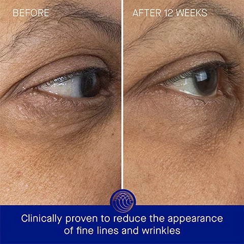 Image 3 - Image showing a side-by-side comparison of an eye area labeled Before on the left and After 12 Weeks on the right, with visible improvement in skin texture and reduced fine lines; text below reads Clinically proven to reduce the appearance of fine lines and wrinkles.
              Image 4 - Image showing a side-by-side comparison of the eye area before and after 12 weeks of treatment, with text indicating the results; visible text includes BEFORE, AFTER 12 WEEKS, and Clinically proven to reduce the appearance of dark circles and increase luminosity.
              Image 5 - A golden cylindrical eye cream bottle is positioned on a light background with softly angled shadows, featuring text that states Clinically Proven Results, The appearance of fine lines are reduced by 57%, Skin hydration is improved by over 3x, Skin luminosity is improved by 2.9x, and a note about a clinical trial.
              Image 6 - An image of a product bottle for eye cream against a blue background, with text stating that 99% agree tired eyes look refreshed, luminous, and well-rested; 99% agree the eye area appears more youthful, tighter, and less crepey; and 95% agree crows feet look noticeably reduced.
              Image 7 - An orange bottle of eye cream with a white cap is placed on a white surface, surrounded by text describing its ingredients: TFC8 - A proprietary technology that creates the optimal environment for skin cellular renewal, Arjun tree extract - Helps firm and combat signs of aging, Duo of seaweed extracts - Minimizes the appearance of puffiness and dark circles, and Vitamin C - Supports collagen production and brightens complexion.
              Image 8 - Image shows three instructional steps for applying a skincare product: Step 1 displays a hand dispensing one pump of product onto fingertips; Step 2 shows a person gently tapping product around their eyes; Step 3 captures a person smoothing the product into their skin, with visible text detailing each step.
              Image 9 - Image shows two eye cream products on a blue background; on the left is The Eye Cream in a pump bottle with text describing it as lightweight, hydrating, and ideal for combination to oily skin, while on the right is The Rich Eye Cream in a jar described as luxuriously rich, lifting, and ideal for combination to very dry or aging skin.
              Image 10 - A list of skincare products titled The Routine includes five steps: 1. Cleanse with The Cream Cleansing Gel, 2. Tone & Exfoliate with The Essence, 3. Correct & Illuminate with The Serum, 4. Balance & Hydrate with The Light Cream, and 5. Revitalize & Refresh with The Eye Cream.
              Image 11 - A brown and gold tube of eye cream labeled THE EYE CREAM WITH TFC8 stands next to a blue and gold bottle, both sitting on a reflective surface, with the text 15 ml Refill and 15 ml visible.
