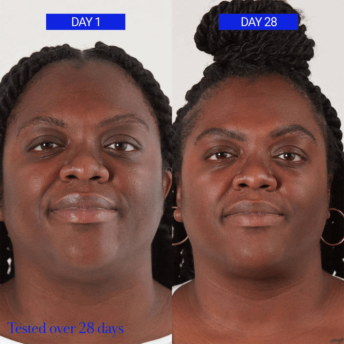 Image 1-3, before and after. Image 4, consumer results.