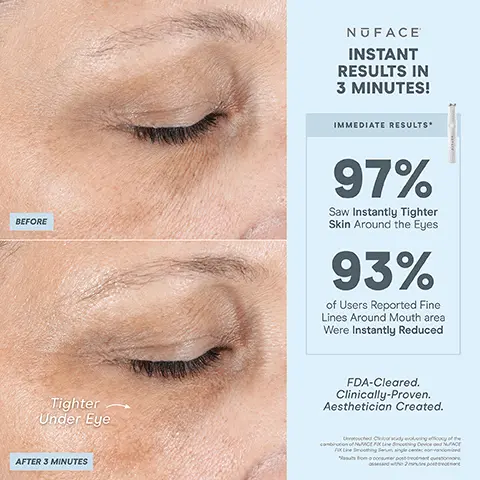 Image 1, NUFACE INSTANT RESULTS IN 3 MINUTES! IMMEDIATE RESULTS* BEFORE 97% Saw Instantly Tighter Skin Around the Eyes 93% of Users Reported Fine Lines Around Mouth area Were Instantly Reduced Tighter Under Eye AFTER 3 MINUTES FDA-Cleared. Clinically-Proven. Aesthetician Created. Chestyy of the FOX Line Smoothing Serum single cente from consumer postrement question Image 2, STEP 3: ACTIVATE + FIX NUFACE LINE SMOOTHING SERUM FIX Serum Activator Your Device's Must-Have Partner Conducts Microcurrent on Skin's Surface Reduces Fine Lines & Wrinkles Brightens Skin LINE SMOOTHING FIX SERUM PEPTIDE COMPLEX WITH TRIPLE 150 for/15 mL