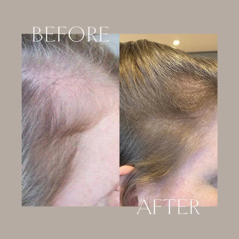 Image 1-3 before and after