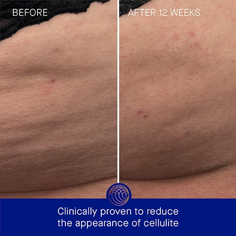Image 3 - A split image showing a close-up of skin before and after treatment; the left side labeled Before shows more visible dimples and texture, while the right side labeled After 12 Weeks appears smoother, with less visible dimpling, along with the text Clinically proven to reduce the appearance of cellulite at the bottom.
              Image 4 - Image shows a comparison of skin on the thigh with stretch marks, labeled BEFORE on the left side and AFTER 12 WEEKS on the right side, along with the text Clinically proven to reduce the appearance of stretch marks at the bottom.
              Image 5 - A blue tube of Augustinus Bader body cream floats in water with text indicating clinically proven results, including a 74% reduction in the appearance of cellulite on the buttocks, a 64% reduction in cellulite on the thighs, and a 64% reduction in the appearance of stretch marks, along with a note about a clinical trial.
              Image 6 - An image of a blue tube labeled Augustinus Bader The Body Cream with visible text detailing user results: 100% agree skin is intensely moisturized and hydrated, 92% agree the appearance of cellulite is reduced, 90% agree the appearance of stretch marks is reduced, alongside a note that says *Based on a 4-week Consumer Perception Study of 55 subjects, aged 35 - 65*.
              Image 7 - A blue tube of Augustinus Bader body cream is shown with text indicating its key ingredients and benefits, including TFC8® for skin renewal, shea butter to reduce stretch marks, bisabolol for skin barrier support, and a polysaccharide moisture complex for hydration and water loss prevention.
              Image 8 - Image shows a tube of Augustinus Bader body cream alongside an applicator spoon with oil on it; visible text includes Step 1 - Dispense desired amount into hands and massage into skin, Step 2 - Reapply as needed, morning, night, and throughout the day, and AB Insider Tip - Layer under The Body Oil for an intensely moisturizing experience.
              Image 9 - Image depicts two skincare products: on the left, a blue tube labeled Augustinus Bader The Body Lotion with descriptors including lightweight lotion, hydrating and soothing benefits, and ideal for all skin types; on the right, a blue jar labeled Augustinus Bader The Body Cream with descriptors including ultra-rich cream, nourishing and firming benefits, ideal for normal to very dry skin.
              Image 10 - Image shows a skincare routine layout with three product steps: 1. Cleanse & Hydrate with a blue body cleanser, 2. Soften & Smooth with a blue body oil, and 3. Hydrate & Firm with a body lotion or cream, with the text The Routine at the top.