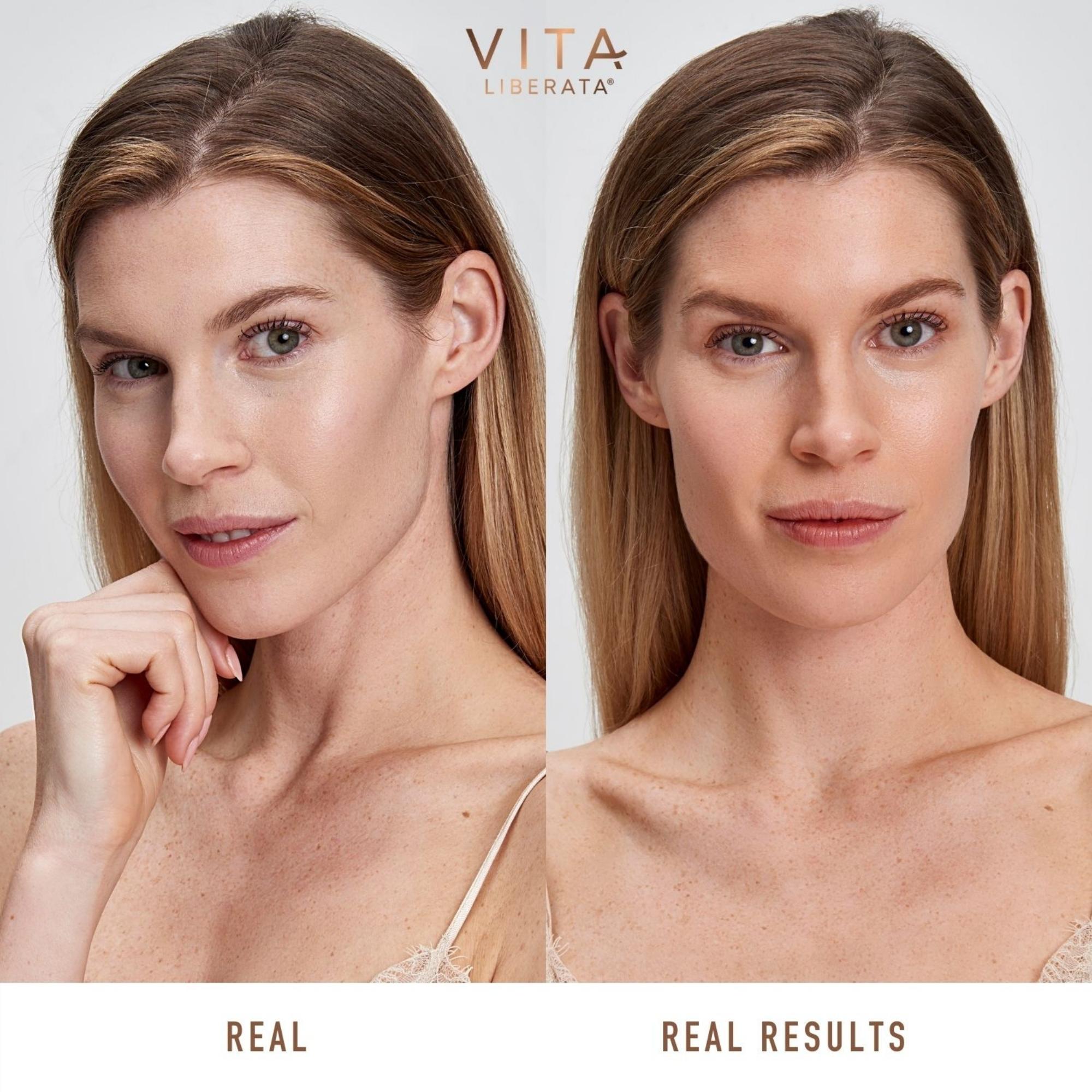 Real and Real Results before and after