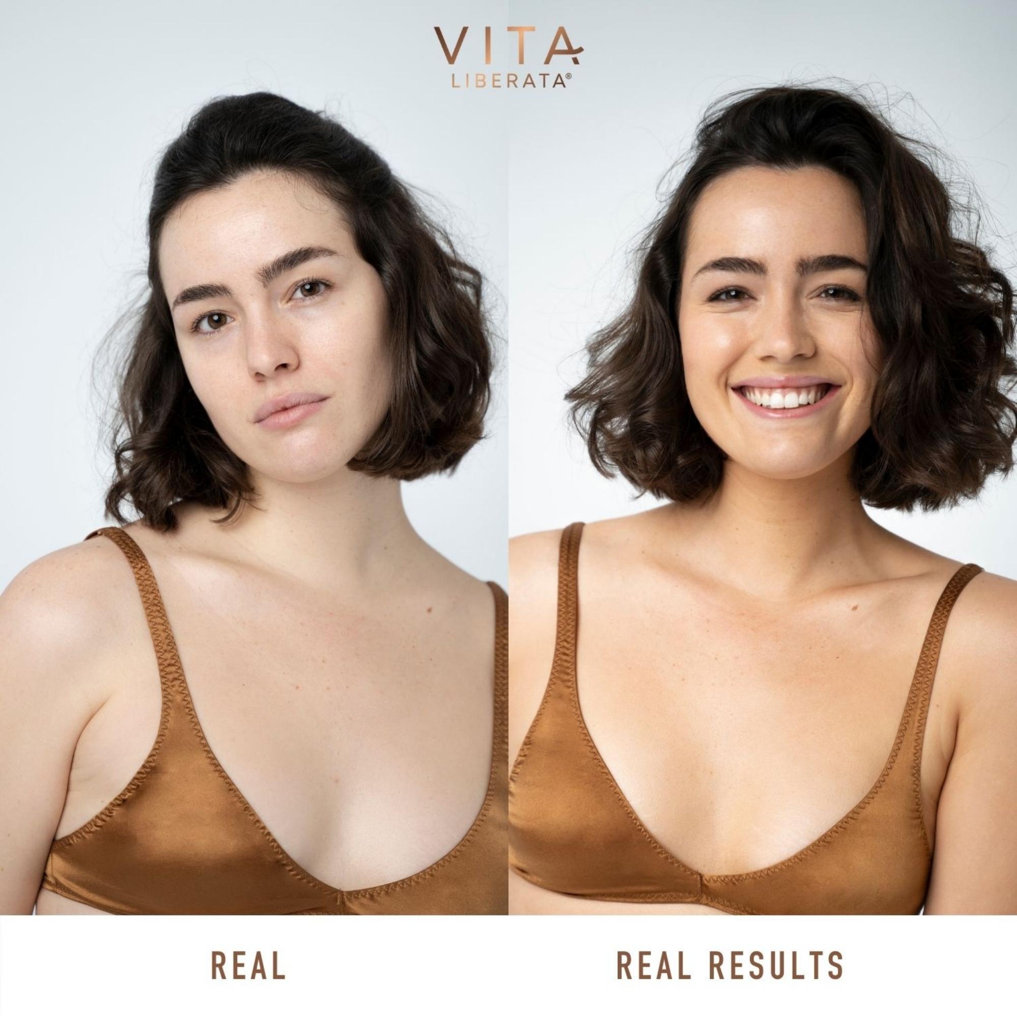 Real and Real Results before and after