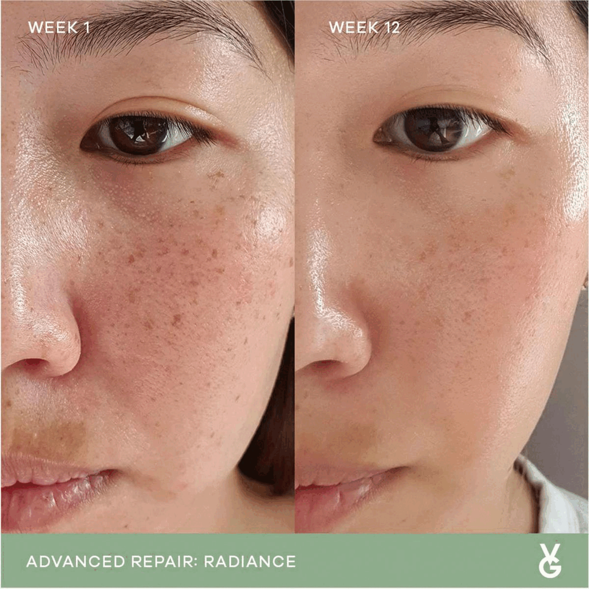 Image 1-2, week 1 vs week 12. Advanced Repair: Radiance. Image 3, 100% Marine Collagen, reduces fine lines and wrinkles, promotes healthy hair and nails, firms and plumps skin, improves elasticity.