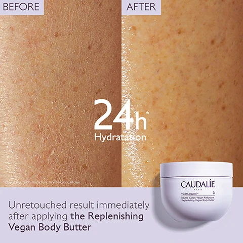 Image 1 - A side-by-side comparison showing skin before and after applying a moisturizer, with the after image indicating improved hydration; the visible text reads 24h Hydratation, Untouched result immediately after applying the Replenishing Vegan Body Butter, and CAUDALIE.
              Image 2 - A person applying a creamy white moisturizer to their arm, with a jar labeled Caudalie in the background, and statistics indicating 90% soothing and 95% anti-itching effectiveness alongside the text Long-lasting comfort.
              Image 3 - Five skincare products are displayed on a light purple background, with labels indicating their use: Step 1 - Hyaluronic Nourishing Body Lotion; Step 1 - Replenishing Vegan Body Butter; Step 2 - Hand & Nail Repairing Cream; Step 3 - Foot Beauty Cream; and visible cream from the Replenishing Vegan Body Butter.
              Image 4 - A round jar of Caudalie Vinotherapist body cream filled with white cream, topped with a dark berry, with text displaying DESERT DATE OIL Reinforces the skin barrier, GRAPE SEED OIL Nourishing, Antioxidant, and SHEA BUTTER Nourishes, regenerates and repairs.
              Image 5 - An image shows a person holding a jar of Caudalie Vinotherapist Body Butter while illustrating recycling instructions that read How to recycle the Vinotherapist™ Body Butter followed by 1. Recycle cap with Terracycle and 2. Dispose of jar in recycling bin.