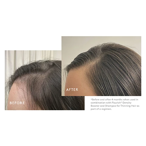 Image 1, before and after 4 months when used in combination with flourish density booster and shampoo for thinning hair as part of regimen. image 2, key ingredients. probiotic ferment = a microbiome known to nourish the scalp, help decrease irritation and support cellular oxygen consumption. cyperus plant root oil = enhances softness, shine and combability without adding weight. biomimetic signal peptides = nourish and calm the scalp to help create a healthy environment for hair growth.