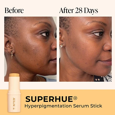 Image 1, before and after 28 days. superhue hyperpigmentation serum stick. image 2, fades the look of dark spots and scars. addresses the look of fine lines and wrinkles. smoothes skin texture. image 3, clinical results. 100% of respondents agreed their skin looked more radiant. 96% of respondents agreed their complexion appeared smoother. 93% of respondents agreed their skin appeared to be more even in tone. in a 3 week consumer study wit 27 participants.