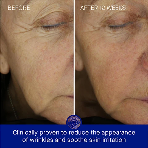 Image 3 - A side-by-side comparison shows a close-up of a womans face labeled BEFORE on the left and AFTER 12 WEEKS on the right, illustrating the reduction of wrinkles and improved skin texture, with visible text stating Clinically proven to reduce the appearance of wrinkles and soothe skin irritation at the bottom.
              Image 4 - A jar of Augustinus Baders Ultimate Soothing Cream is shown with claims of clinically proven results stating that skin hydration is improved by 2.8x, fine lines are visibly reduced by 78%, and wrinkles are reduced by 79%, with a footnote about a clinical trial.
              Image 5 - Image shows a blue jar of The Ultimate Soothing Cream by Augustinus Bader with a gold lid, alongside text highlighting user proven results including 100% agreement that irritated skin feels instantly soothed and calmed, 95% agreement that skin barrier feels balanced and restored, and 100% agreement that skin feels nourished and replenished, with a note about a consumer perception study.
              Image 6 - A blue jar of Augustinus Baders The Ultimate Soothing Cream with a bronze lid sits against a dark gradient background, surrounded by descriptions of its key ingredients: TFC8® that promotes skin cellular renewal, Totarol that neutralizes free radicals, Evening Primrose that improves skin elasticity and texture, and Black Cumin Oil that soothes dry skin and calms redness.
              Image 7 - Three moisturizer products are displayed in a side-by-side comparison: The Cream is a lightweight daily moisturizer suitable for combination to oily skin, The Rich Cream is a luxuriously rich daily moisturizer ideal for normal to dry skin, and The Ultimate Soothing Cream is an ultra-rich balm designed for very dry or irritation-prone skin, with accompanying descriptions of textures, benefits, concerns, and ideal skin types for each product.
              Image 8 - A skincare routine labeled The Routine includes four steps: 1. Cleanse - The Cream Cleansing Gel, 2. Correct & Hydrate - The Serum, 3. Nourish & Renew - The Ultimate Soothing Cream, and 4. Perfect & Revitalize - The Eye Cream, alongside corresponding product images.