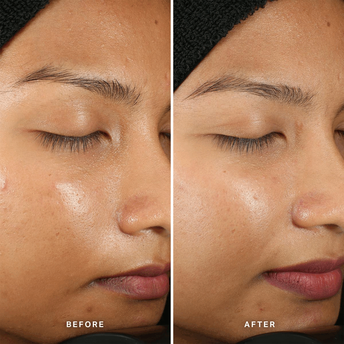 Two images transiting into each other in an endless loop. Image one: Text reads Before and After. Description - The before image shows skin before use. In the after image the skin appears smoother, clearer and skin is visibly luminous. Image two: Text reads Before and After. Description - The before image shows skin before usw. In the after image the skins redness has been reduced and appears smoother and calmer. 