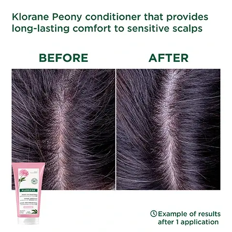 Image 1, klorance peony conditioner that provides long lasting comfort to sensitive scalps. before and after. example of results after 1 application. image 2, with or no rinse. 95% of natural origin ingredients. biodegradable formula. without animal origin ingredients. image 3, 1 = wash, 2 = detangle.