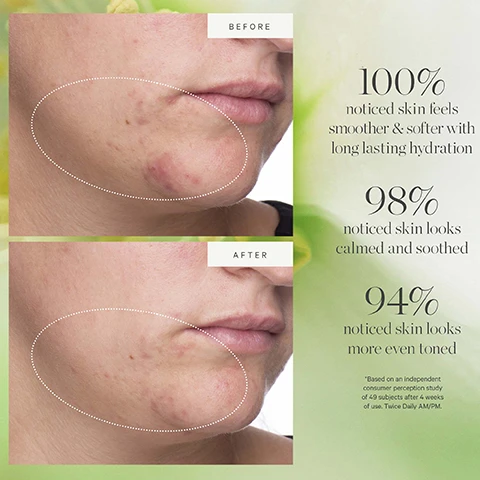 Image 1, before and after. 100% noticed skin feels smoother and softer with long lasting hydration. 98% noticed skin looks calmed and soothed. 94% noticed skin looks more even toned. based on an independent consumer perception study of 49 subjects after 4 weeks of use, twice daily AM and PM. image 2, microalgae, balance, calm and refresh. image 3, keep your glow without the waste. how to recyle active algae lightweight moisturiser. remove empty pod, rinse out any remaining or excess product, recycle the pod. place new refill pod into glass jar.