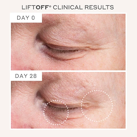 Image 1 - Image showing clinical results of a skincare product with two close-up photos of an eye area labeled DAY 0 on the top and DAY 28 on the bottom, with visible changes in skin texture and appearance, including dotted circles highlighting areas of improvement.
              Image 2 - A side-by-side comparison of a mans forehead showing skin before treatment on Day 0 and after 28 days, with noticeable reduction in wrinkles; visible text includes LIFTOFF® CLINICAL RESULTS, DAY 0, and DAY 28.
              Image 3 - Image shows a side-by-side comparison of a persons face indicating skin appearance changes from day 0 to day 28, with highlighted areas showing reduced fine lines and wrinkles; visible text includes LIFTOFF® CLINICAL RESULTS, DAY 0, and DAY 28.
              Image 4 - A person holds a white skincare device with two metal spheres at the top, labeled MAGNITONE LONDON, accompanied by several text points on the right, including Clinically proven to improve skin firmness, A workout for your face, Just 5 minutes/day to see results, Microcurrent technology, 4 strength settings, Hypoallergenic skin contacting points, 5 second timer, and USB rechargeable.
              Image 5 - A smiling woman with freckles uses the Magnitone LiftOff microcurrent facial toning device on her cheek, with text that reads LIFTOFF Microcurrent Facial Toning Device In a clinical study of 20 participants, regular use of the Magnitone LiftOff with the Super Conductive Gel was shown to Significantly firm skin by up to 47% With regular use over 4 weeks. Individual results will vary.
              Image 6 - A young man with short hair is smiling while using a gray facial toning device on his cheek, and there are award badges in the corner that read Beauty Awards Platinum Winner 2024, Woman&Home Clever Skincare Winner 2021 Best Facial Toning Tool, and Menopause Friendly Clinically Proven.
