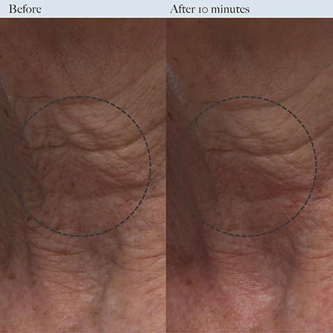 Image 1 - Side-by-side comparison of a persons neck skin showing wrinkles and lines labeled Before on the left and smoother skin labeled After 10 minutes on the right, with both images enclosed in dashed circles.
              Image 2 - Image shows two side-by-side comparisons of a skin area with the left labeled Before and the right labeled After 10 minutes, highlighting a visible improvement in skin texture.
              Image 3 - Image shows three clear blocks with key skincare ingredients: a block contains a creamy substance labeled Bio-Fermented Polish with a description about exfoliating dead skin cells, another block showcases pomegranate seeds labeled Pomegranate Enzyme with its exfoliating properties, and the last block is labeled Niacinamide with a description highlighting its benefits for skin hydration and barrier fortification.