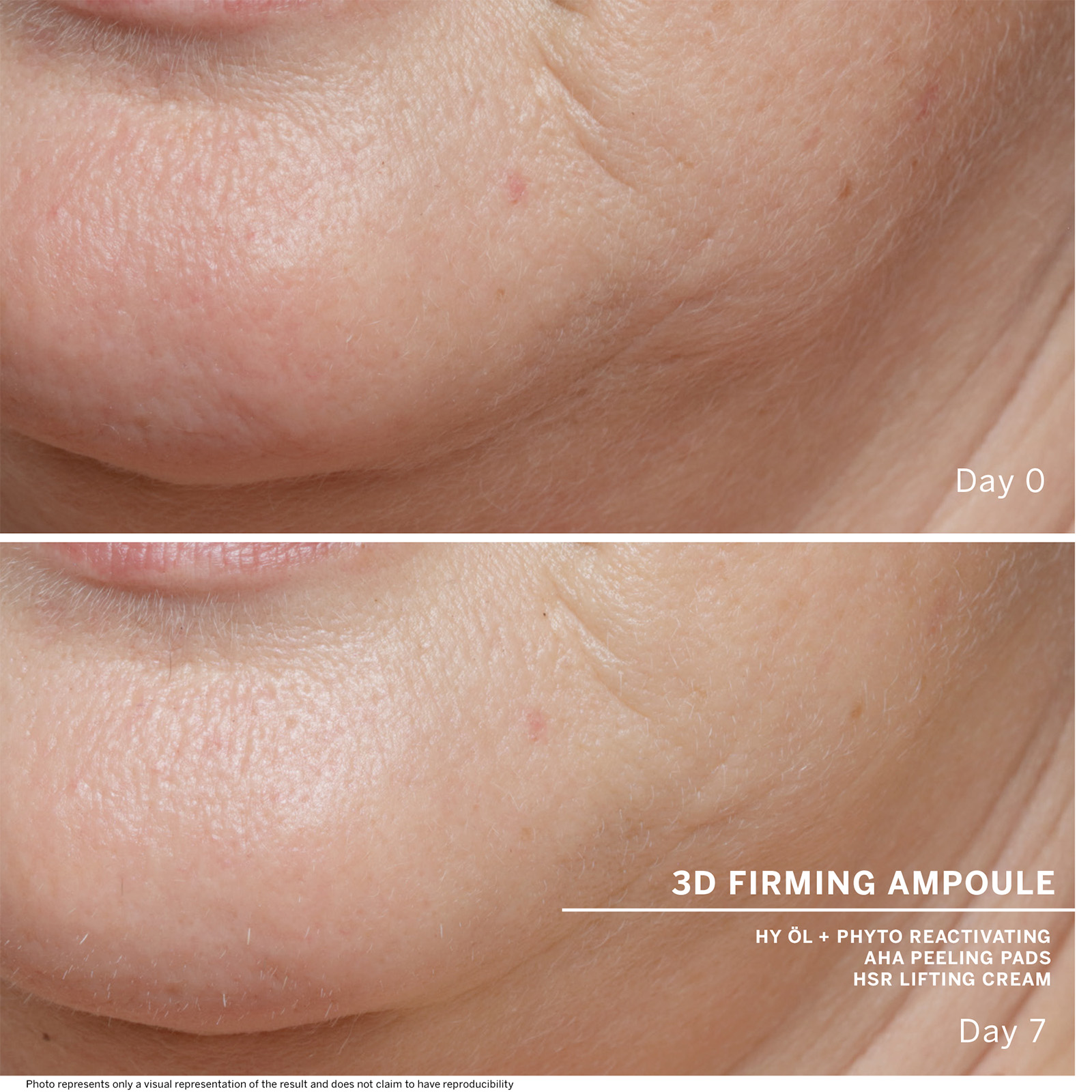 Day 0 3D Firming Ampoule Hy Öl + Phyto Reactivating Aha Peeling Pads Hsr Lifting Cream (Description: Skin before use) Day 7 (Description: skin appears visibly firmer) Photo Represents Only A Visual Representation Of The Result And Does Not Claim To Have Reproducibility 