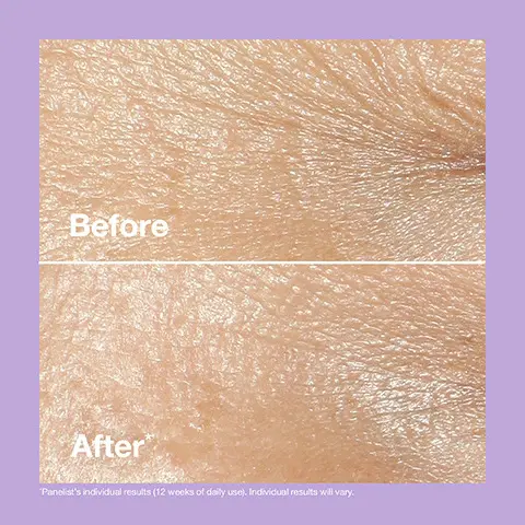 Image 1, Before and after shot. Image 2, 85% says lines and wrinkles look reduced. Image 3, How to use. Image 4, How to recycle. 