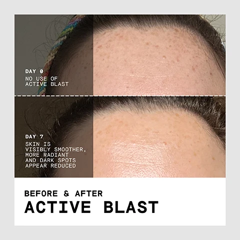 Image 1 - Before and after images of a forehead showing results after 7 days of product use, with text reading Day 0 No Use of Active Blast, Day 7 Skin is Visibly Smoother, More Radiant and Dark Spots Appear Reduced, Before & After Active Blast. Image 2 - Split image of a face showing before and after results with text DAY 0 NO USE OF ACTIVE BLAST DAY 7 SKIN IS VISIBLY SMOOTHER AND MORE RADIANT BEFORE & AFTER ACTIVE BLAST.