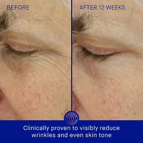 Image 3 - Side-by-side comparison of an older persons face showing wrinkles and skin texture before and after 12 weeks of treatment, with visible text stating BEFORE on the left and AFTER 12 WEEKS on the right, along with Clinically proven to visibly reduce wrinkles and even skin tone at the bottom.
              Image 4 - A blue bottle of The Light Cream by Augustinus Bader is displayed against a light background, with text indicating that skin sebum is reduced by 38%, pores look 54% less noticeable, and skin hydration is improved by 3.1x, along with a note about a 12-week clinical trial.
              Image 5 - Alt text generation failed
              Image 6 - Alt text generation failed
              Image 7 - Alt text generation failed
              Image 8 - Alt text generation failed
              Image 9 - Alt text generation failed